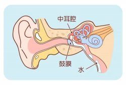 科普：耳朵进水了怎么办？