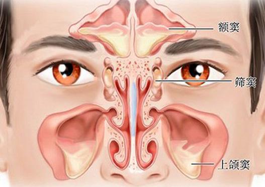 6个方法预防鼻窦炎